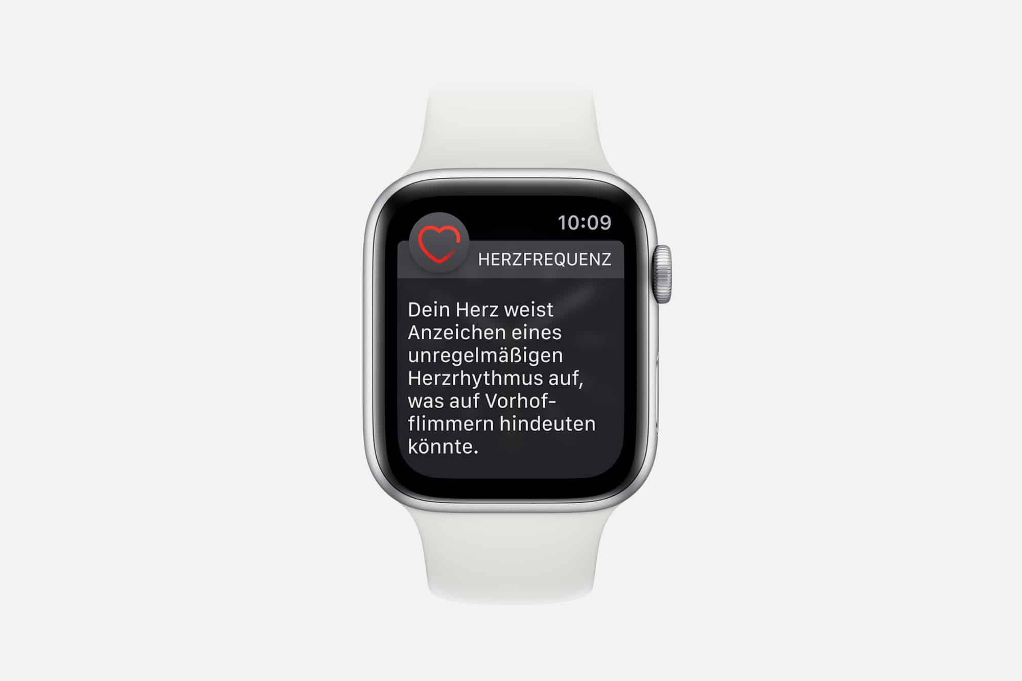 Apple Watch zeigt keine Unregelmäßigkeiten beim EKG an