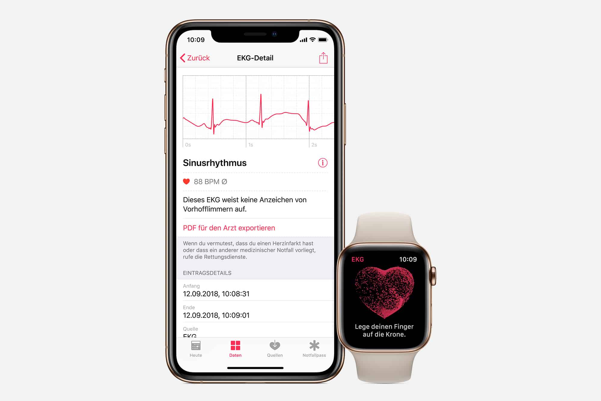 Ergebnisse des EKG an deinen Arzt per PDF senden