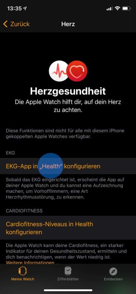 Apple Watch EKG Funktion einrichten