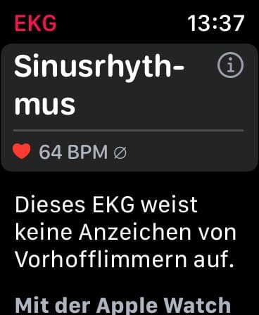 Apple Watch EKG Ergebnis ansehen